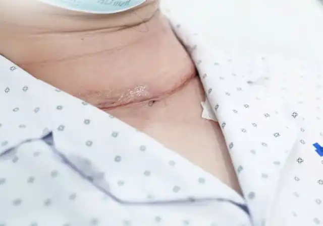 Phi công đang khỏe mạnh bất ngờ phát hiện ung thư tuyến giáp: Điều nên làm để phòng ngừa ung thư tái phát